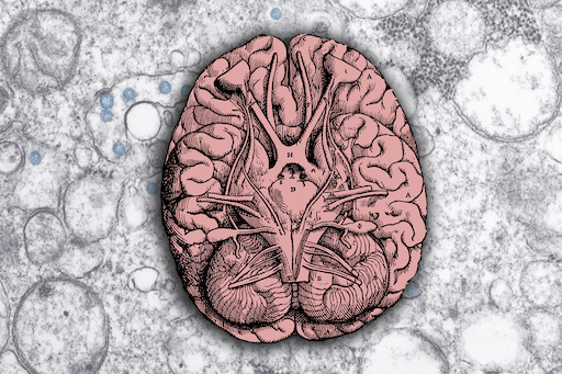 3D 'Assembloid' Shows How SARS-CoV-2 Infects Brain Cells